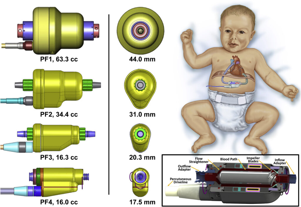 Spring-Energized Seals in Medical Devices